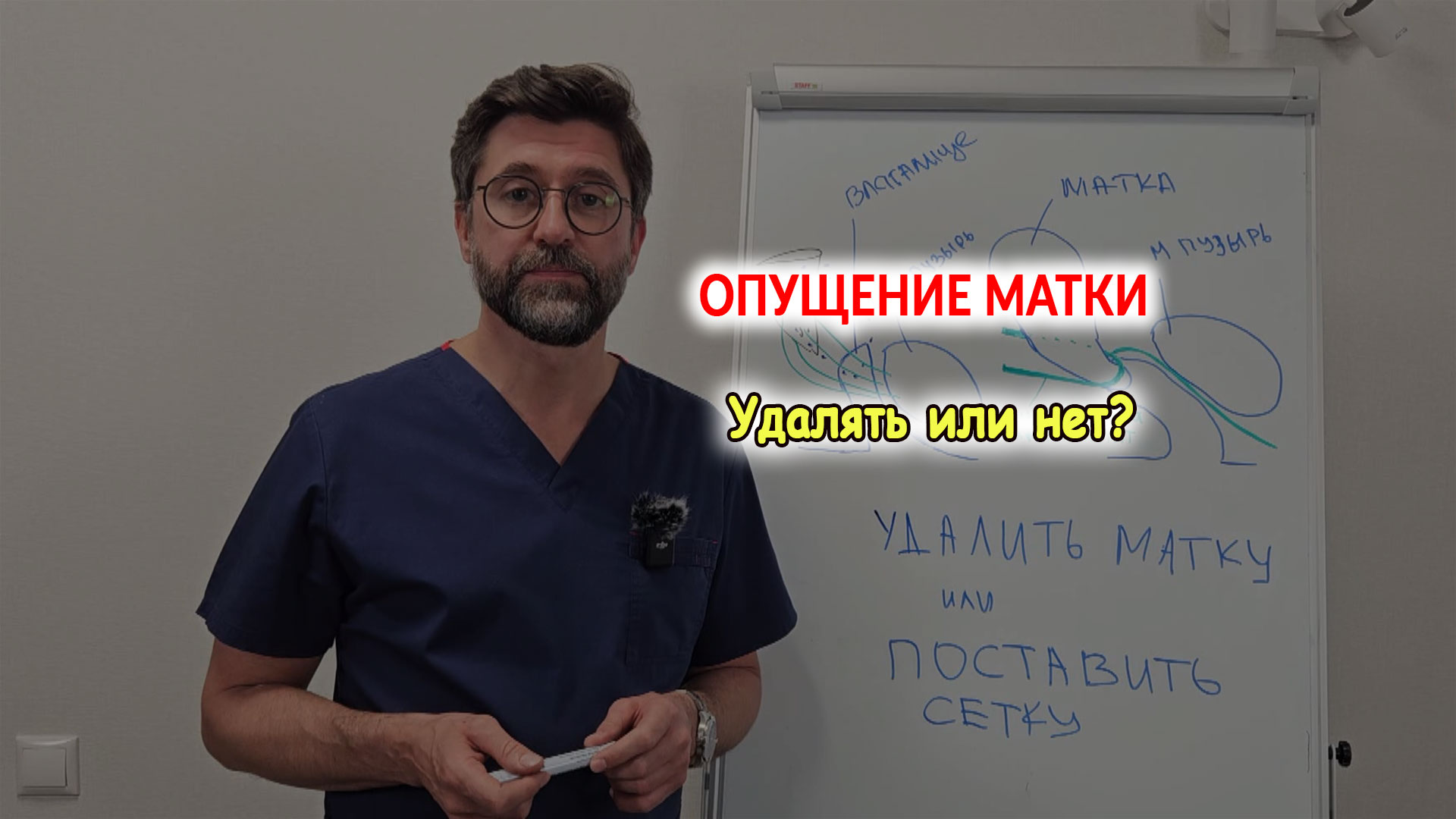 Методы лечения опущения матки