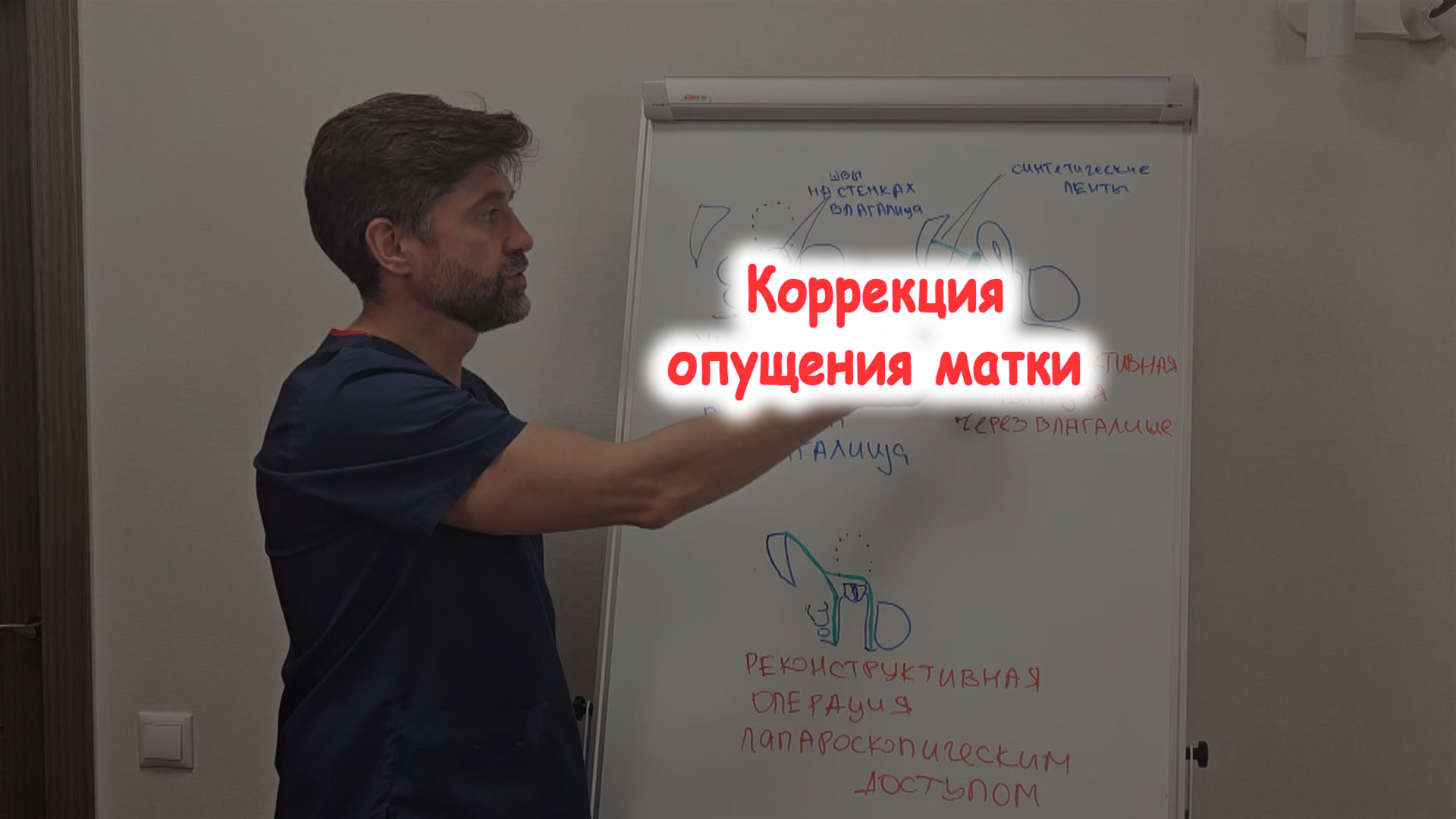 Коррекция опущения матки