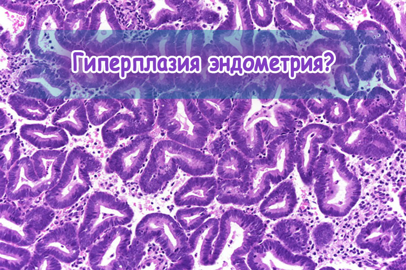 Гиперплазия эндометрия и рак матки