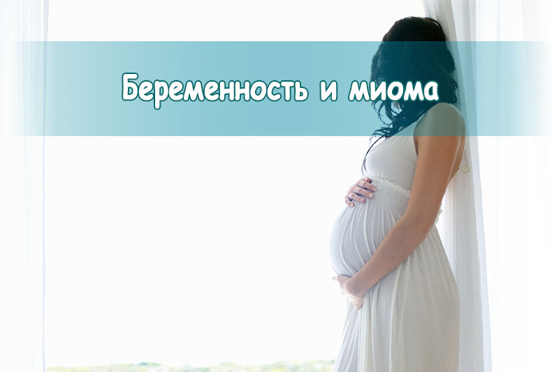 Беременность и миома