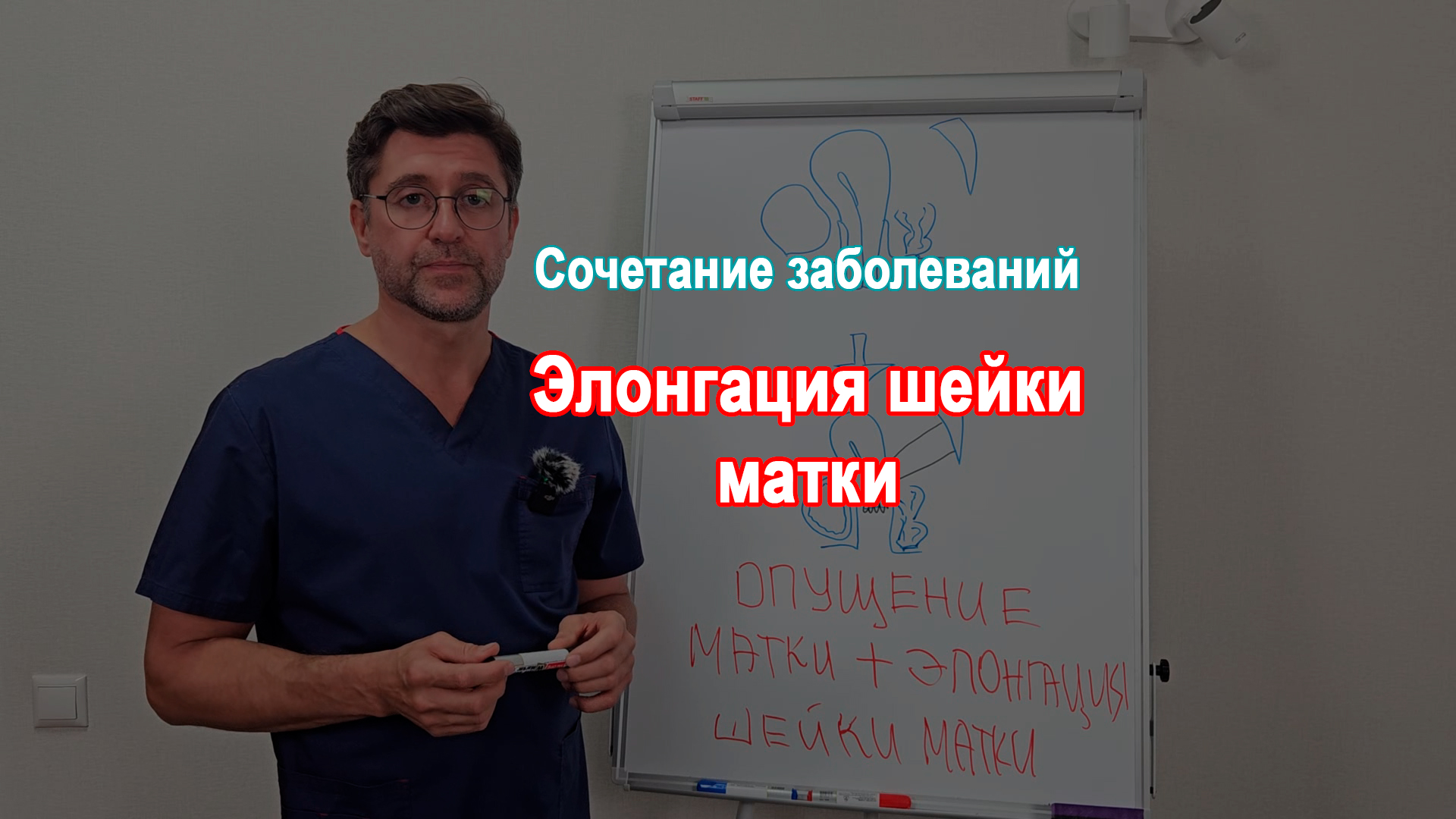 Опущение матки и элонгация шейки матки