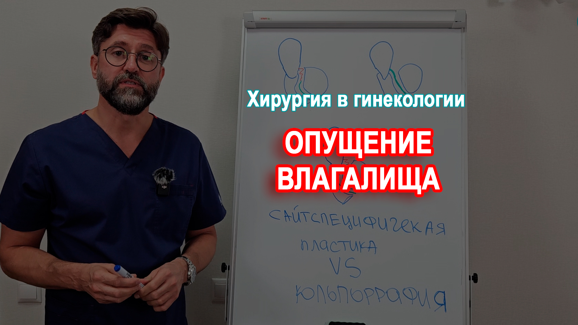 Опущение влагалища. Варианты лечения