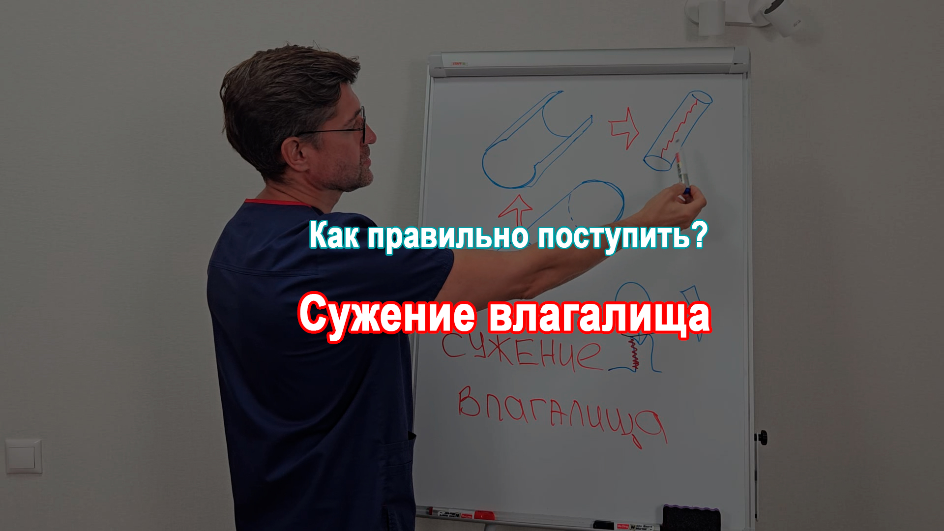 Сужение влагалища. Как правильно поступить?