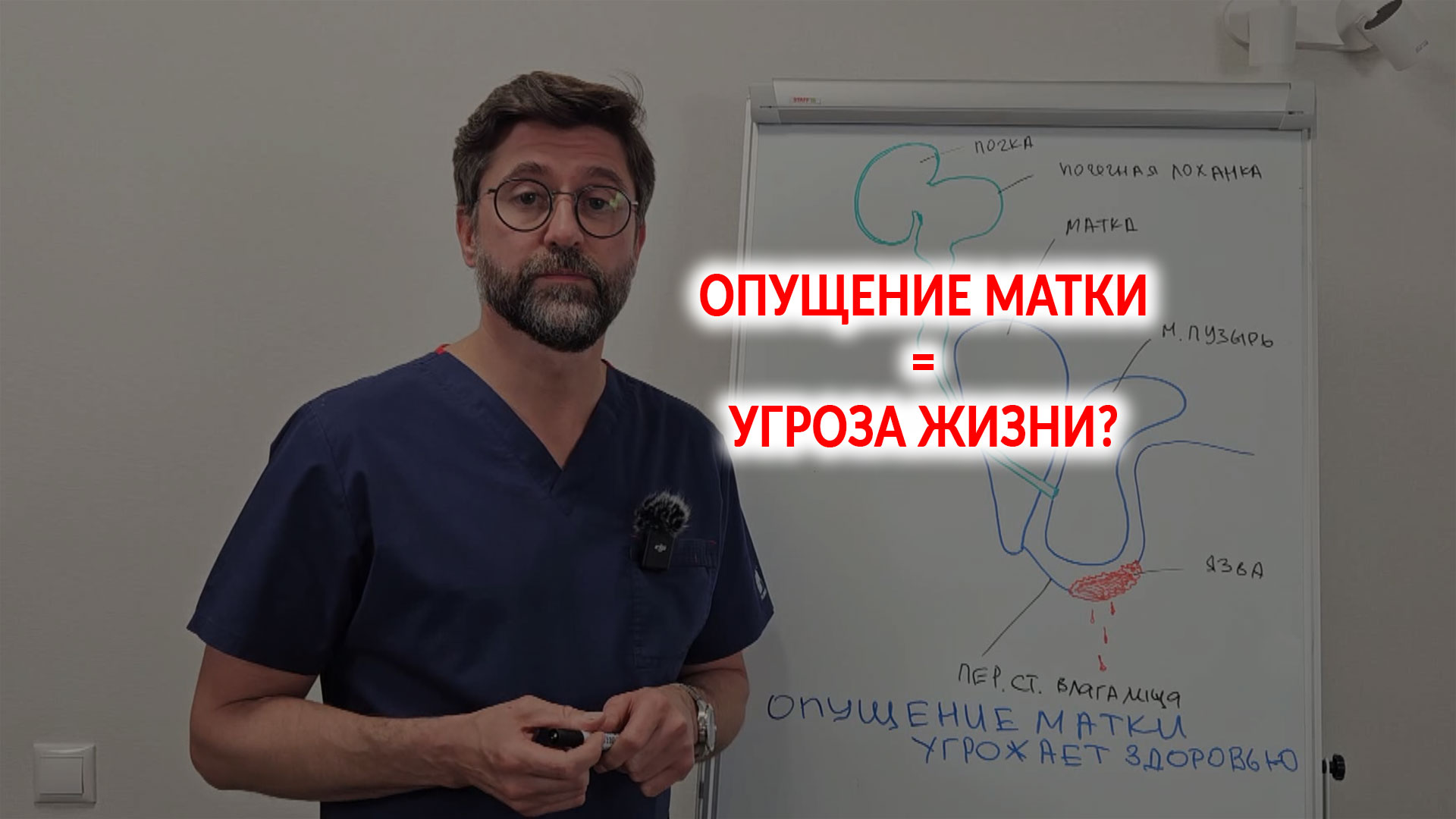 Опущение матки. Угроза жизни