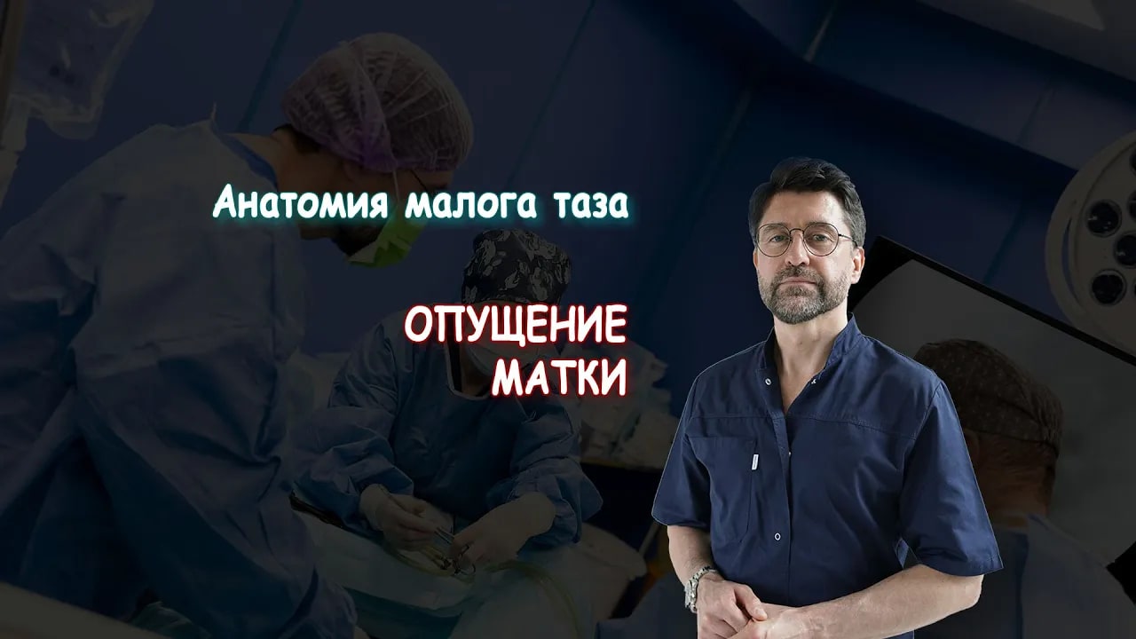 Опущение матки