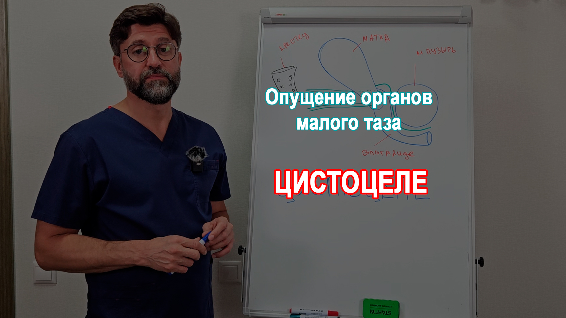 Цистоцеле. Нужна ли передняя кольпорафия?